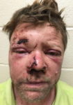 Slippery Rock Man Sues New Castle Police Citing Excessive Force